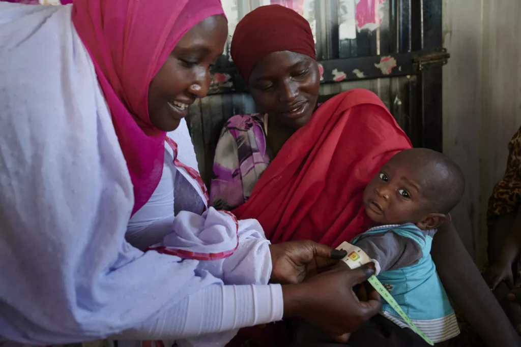 UN Report: 4.2 Million Children Face Acute Malnutrition in Sudan